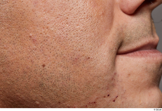HD Face Skin Gabriel Ros cheek face lips mouth skin…